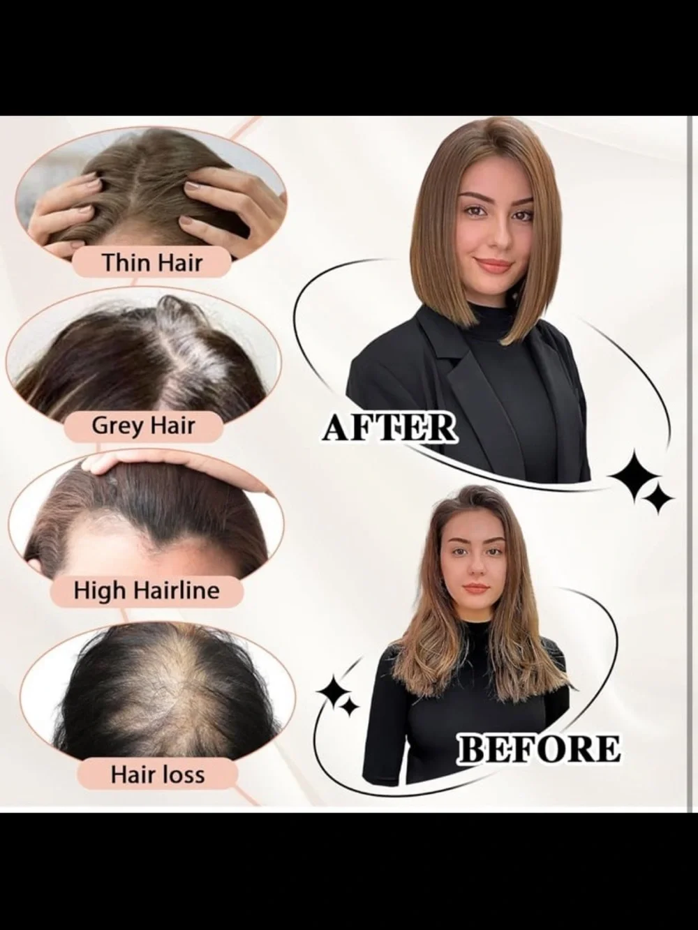 12” Human Hair Topper Clip In Hair Topper Crown Thinning Grey Coverage 5x5